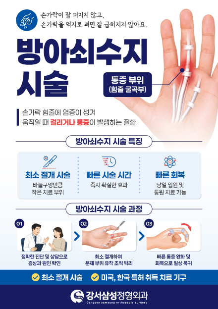방아쇠수지